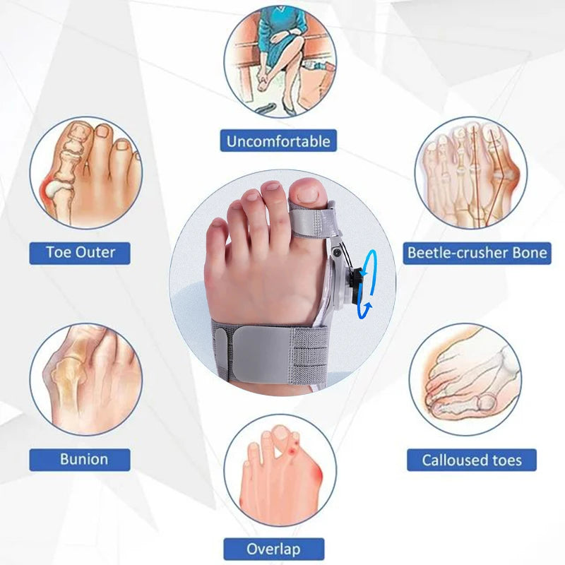 Akasora Align™ – Adjustable Rotating Bunion Corrector for Men & Women