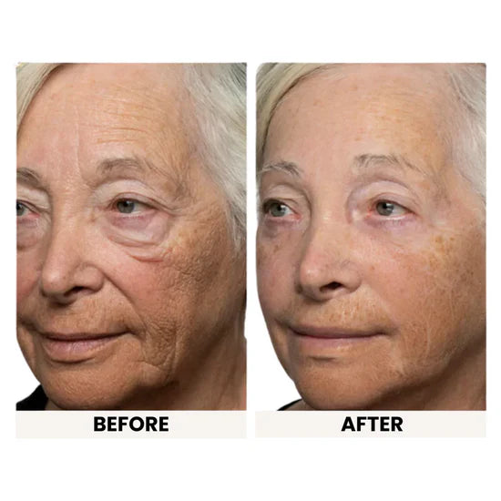 Instant Eye Tightener