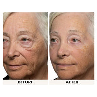 Instant Eye Tightener