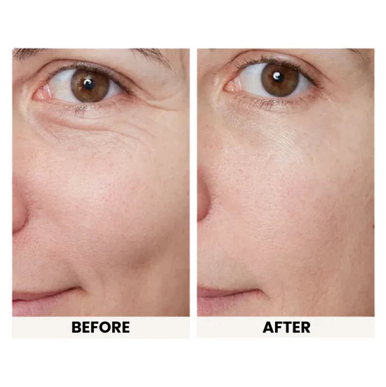 Instant Eye Tightener